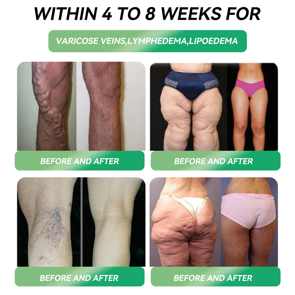 ð¬ð§ð¶ððððððð ðºðððð | Thomasweightloss®ð©ââïžðºð¿ð-ð ðð¢ð± ð¢ð§ ðð§ð ð¯ððððð ðºððððððð ð¶ððð ð³ððððð
(ðð®ð¬ð ðšð§ðð ð ððð², ð¯ð¢ð¬ð¢ðð¥ð ðð¡ðð§ð ðð¬ ð¢ð§ ð ððð²ð¬ïŒ â
ð
ðšð« ðšððð¬ð¢ðð², ððð«ðð¢ðšð¯ðð¬ðð®ð¥ðð« ð¡ððð¥ðð¡, ðð¢ðððððð¬, ð¬ð¥ððð© ðð©ð§ðð, ðð®ð ðððð¥ðð¡, ð£ðšð¢ð§ð ð¢ð¬ð¬ð®ðð¬, ðð§ð ðŠðšð«ð